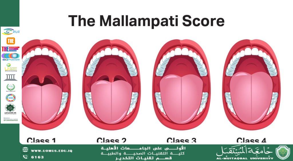 The Mallampati Test: A Tool for Predicting Difficult Intubation