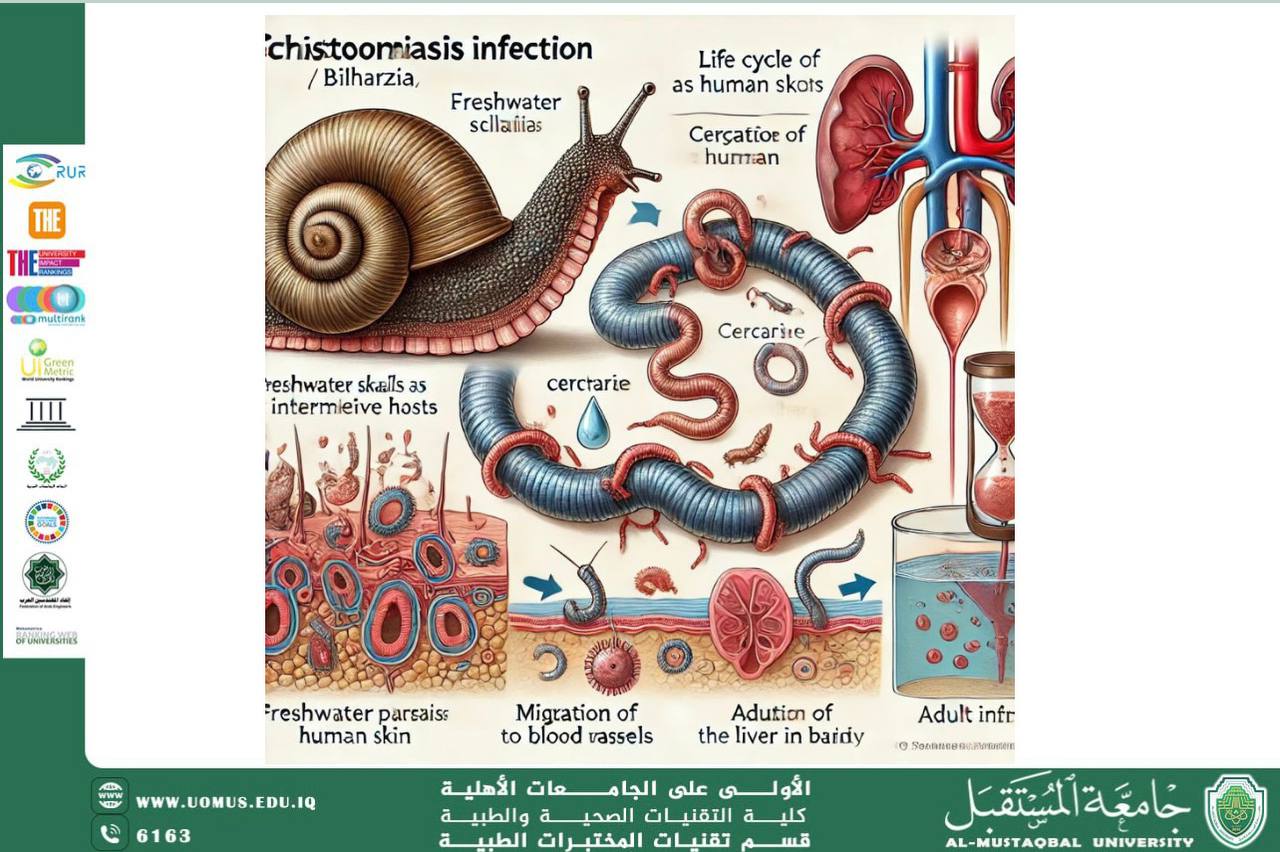 مقالة علمية للسيدة زينب محمود حاتم بعنوان البلهارسيا 