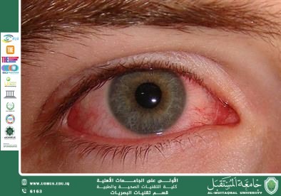 مقالة علمية للتدريسي غيث علي محمود بعنوان(تأثير النوم على صحة العين ).