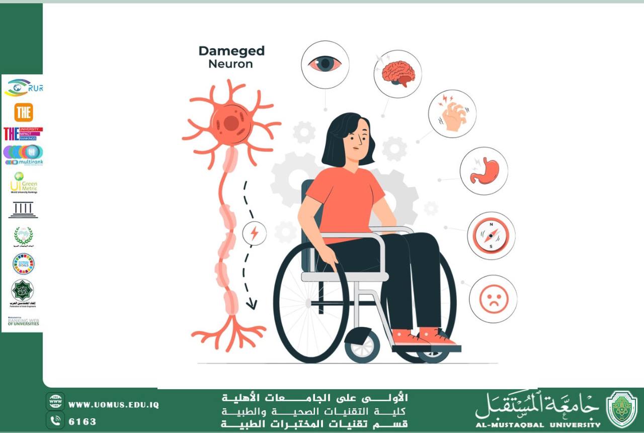 مقالة علمية للتدريسية رقية كريم عباس بعنوان التصلب اللويحي