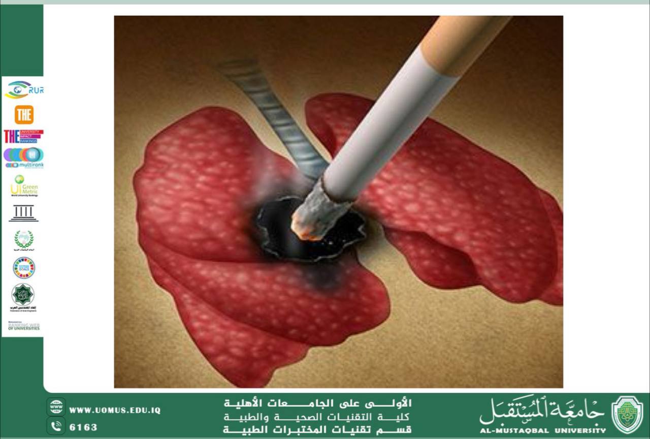 مقالة علمية للسيدة دعاء فاضل كاظم بعنوان التدخين وخطر الاصابة بسرطان الرئة