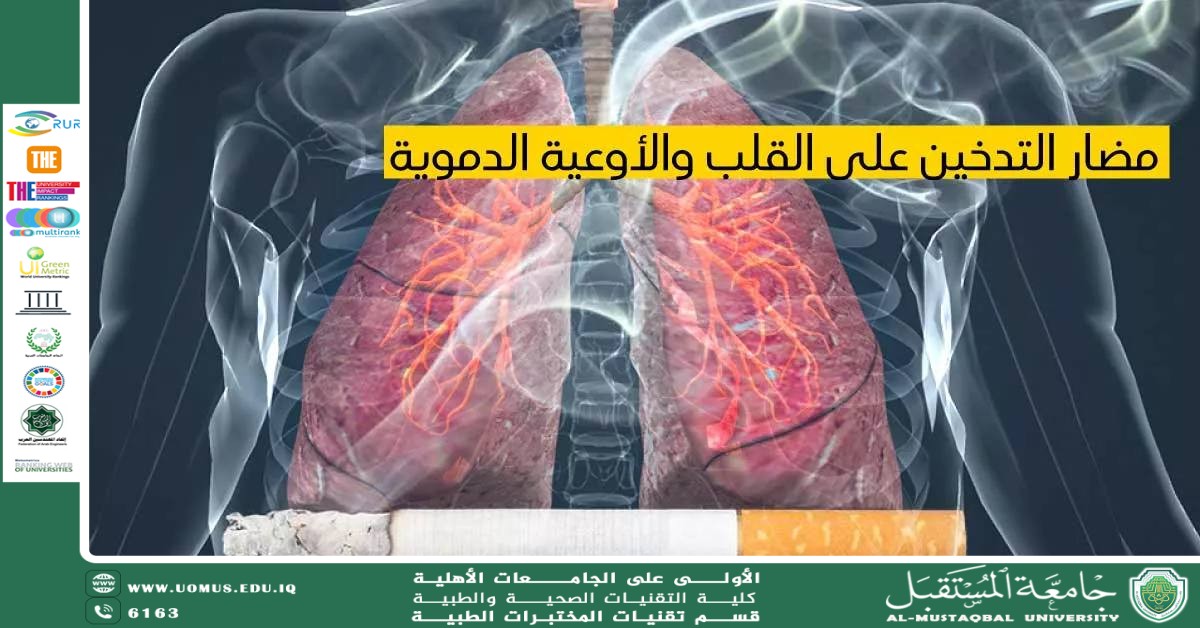 مقالة علمية للسيدة ايمان حامد شمخي بعنوان علاقة التدخين بتصلب الشرايين