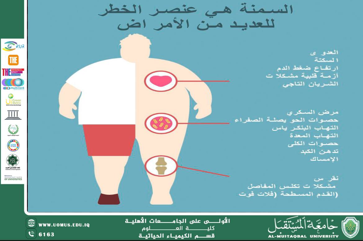 مقالة علمية للدكتور اصيل عامر هادي  بعنوان(السمنة المفرطة وتأثيرها على صحة الإنسان)