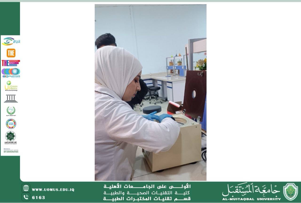 ورشة علمية لقياس نسبة اللزوجة في الدم لدى المدخنين  