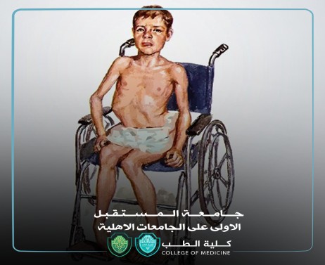 مقالة بعنوان مرض دوشين للدكتورة زهراء طارق حسون تدريسية في كلية الطب جامعة المستقبل