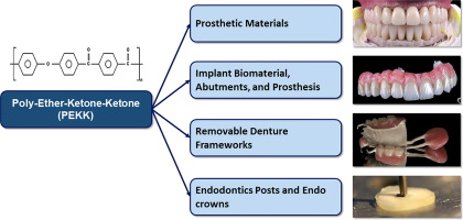مقالة علمية بعنوان (What is PEEK used for in dentistry? ) 