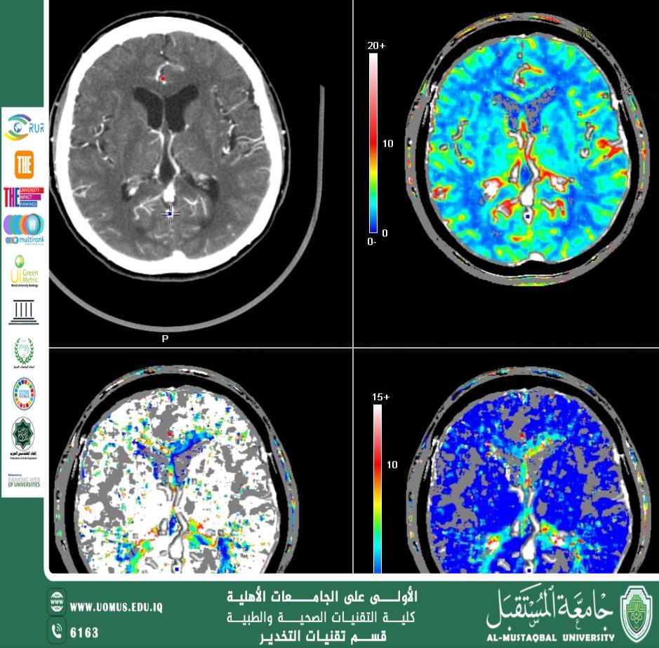  الصبغة وتأثيرها على الجسم أثناء الفحص بالمفراس