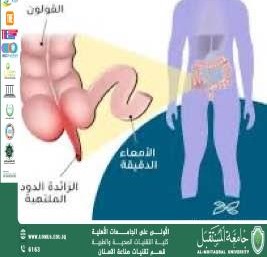  الزائدة الدودية: وظيفتها وأسباب التهابها وعلاجها