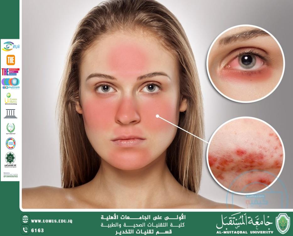 تأثيرات الشمس على البشرة