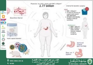 Effects of General-Epidural Anesthesia on Perioperative Hemodynamics and Recovery in Patients with Myasthenia Gravis Undergoing Thymectomy: A Randomized Controlled Study