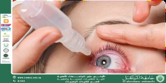 مقالة علمية لرئيس قسم تقنيات البصريات أ.م.د منذر سمين شكر بعنوان (مشاكل العين التي قد تصاب في الصيف)