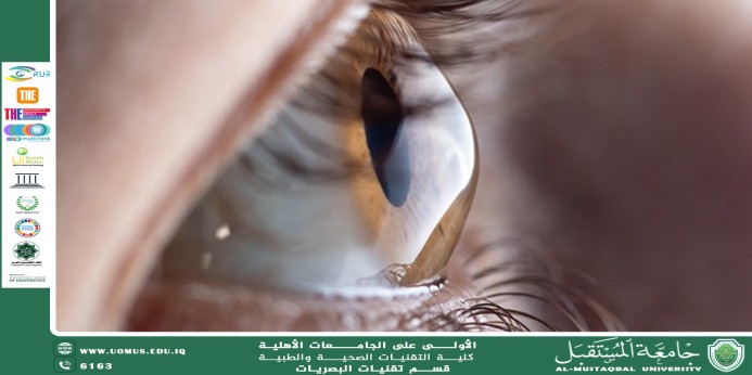 مقالة علمية للتدريسي م.م. حسن عبد الهادي الجابري بعنوان ((التقنيات الحديثة لزراعة قرنية العين: التطورات والابتكارات))  