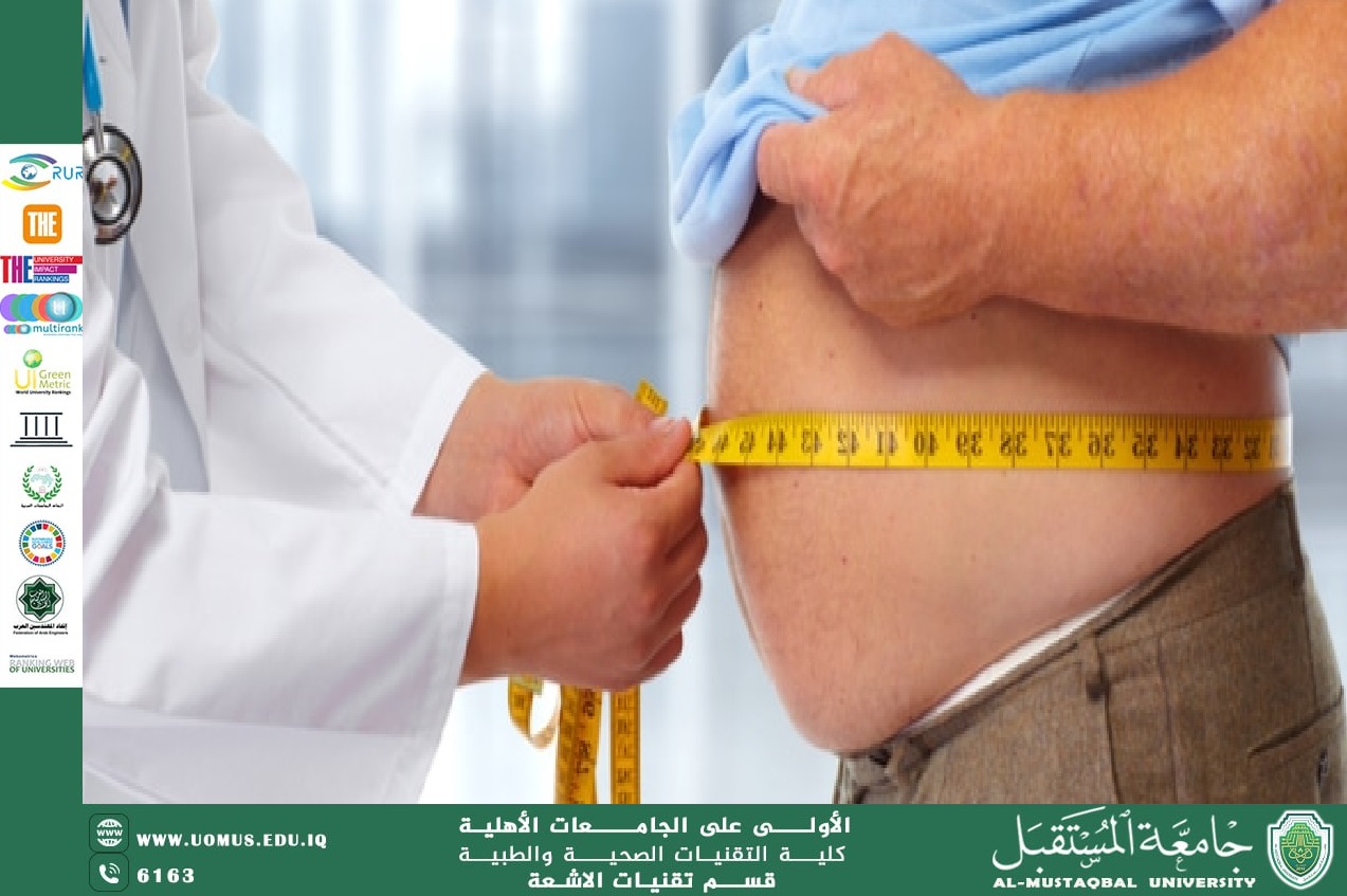 مقالة بعنوان " السمنة: الأسباب، المخاطر، وسبل الوقاية والعلاج  " بقلم الدكتورة سالي علوش 