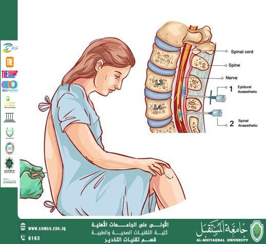 تاريخ التخدير النصفي