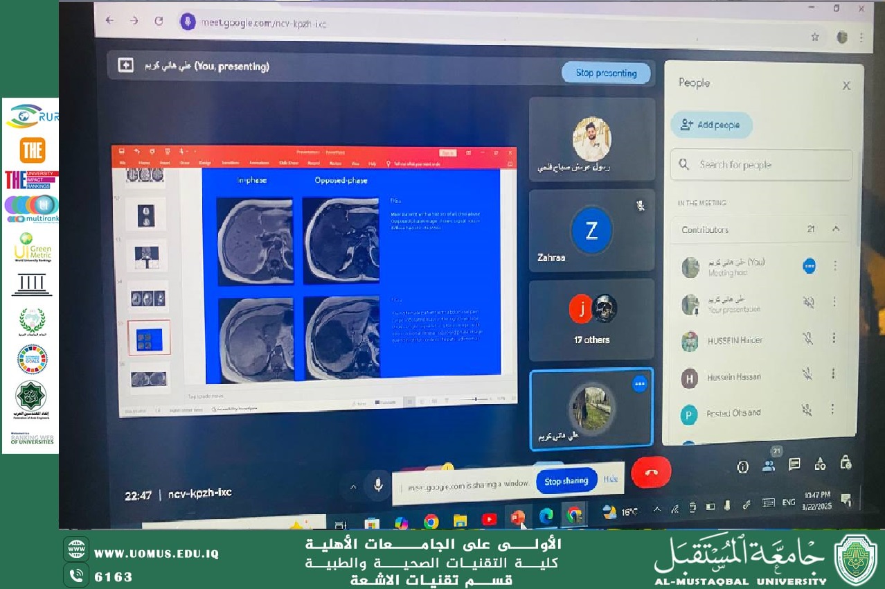 استمرار المحاضرات الإلكترونية التعويضية في قسم تقنيات الاشعة  لطلبة المرحلة الثانية من قبل الأستاذ علي هاني