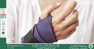 Carpal tunnel syndrome