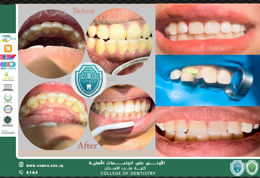 قسم من عمل طلاب كلية طب الأسنان في عيادة أمراض اللثة