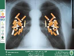 مقالة علمية للمعيدة حوراء علي بعنوان (التدخين السلبي وتأثيره الكيميائي: خطر غير مباشر يهدد الصحة  )