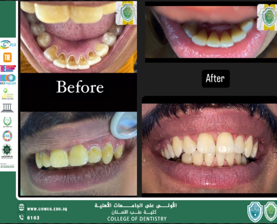 أبداع طالبة في تنظيف أسنان احد المراجعين 