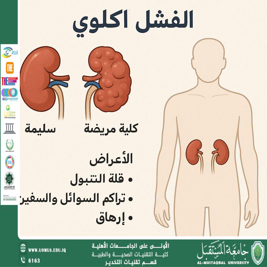 ♕الفشل الكلوي: الأسباب، الأعراض، التشخيص والعلاج