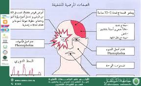 داء الشقيقة