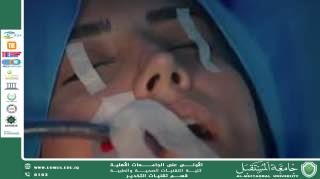 العمى الناتج عن التخدير العام: حالة نادرة لكنها خطيرة