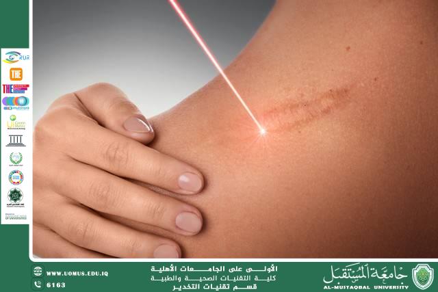  استخدامات الليزر في الطب التجميلي