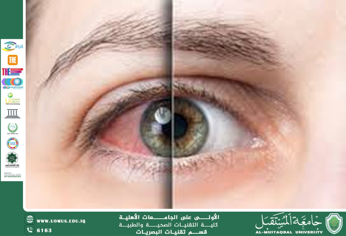 مقالة علمية لرئيس قسم تقنيات البصريات أ.م.د.منذر سمين شكر بعنوان(الإسعافات الأولية لاصابات العين )