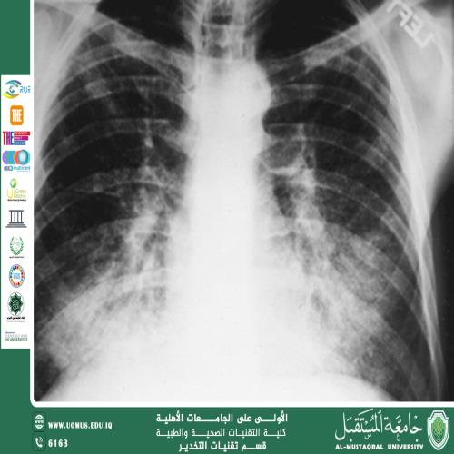 التشعب الرئوي: فهم الهيكل والوظيفة