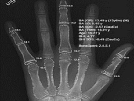 الذكاء الاصطناعي ودوره المتنامي في المجال الطبي