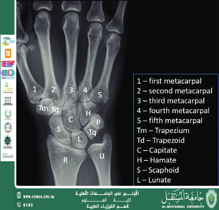 Medical Image Analysis Using Artificial Intelligence Artical Dr. Feryal Ibrahim Althefery
