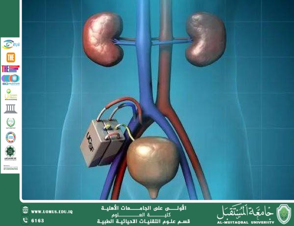 مقالة علمية للتدريسية (م.م سارة رحيم حمزة) بعنوان ""الكلى الصناعية ..ثورة في عالم الطب""