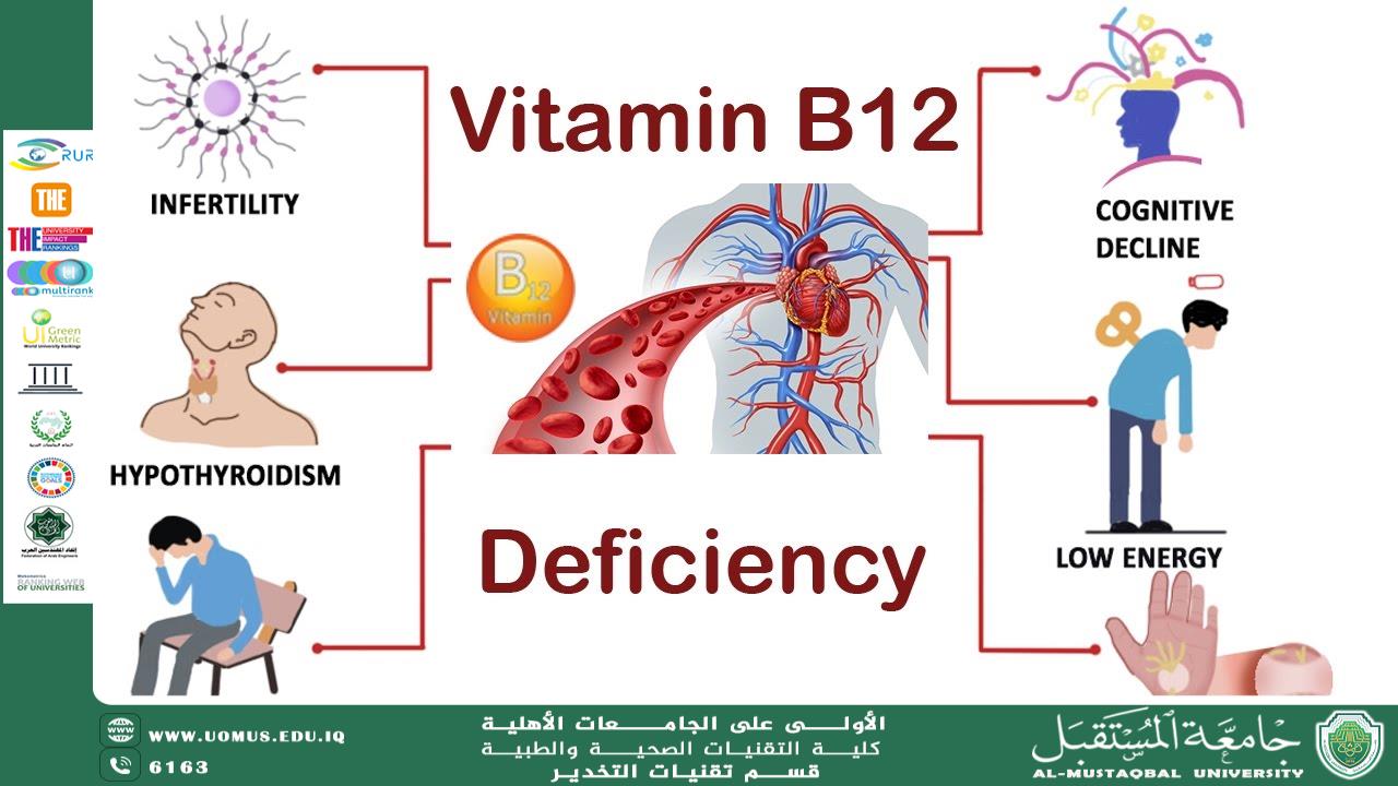 /B12 dificiency