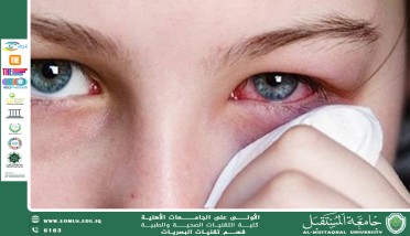 مقالة علمية للتدريسية م.م.نور خميس بعنوان(التراخوما).