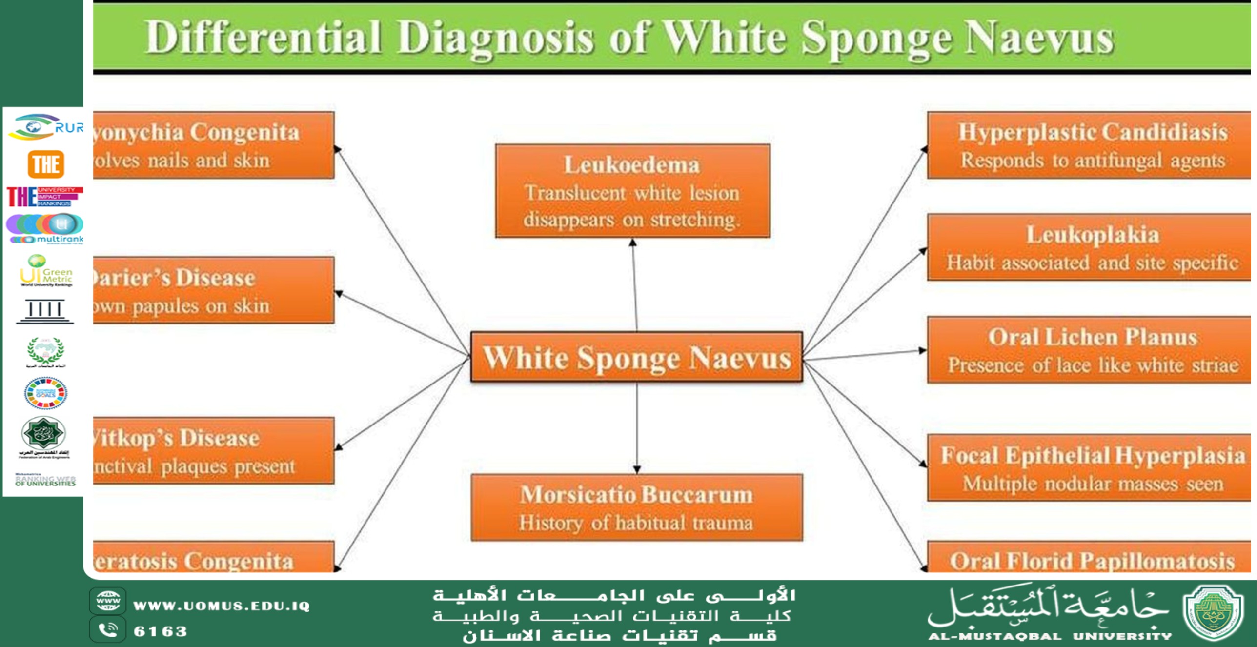 White Sponge Nevus