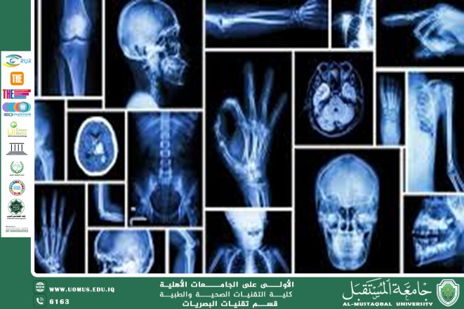 مقالة علمية للمعيدة زهراء عباس علي بعنوان (تأثير الاشعة على جسم الانسان ).