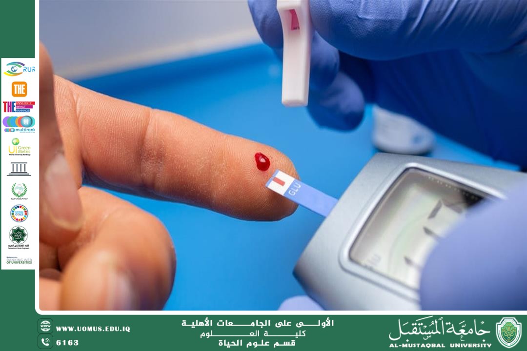 A scientific article by the lecturer (Assistant Professor Zainab Nazim Aziz) entitled “Diabetes”