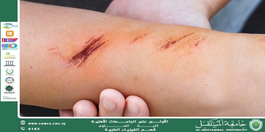 A scientific article by the teaching assistant (Iftikhar Thamer) entitled “The Relationship between Diabetes and Cancer: A Comprehensive Scientific Study”