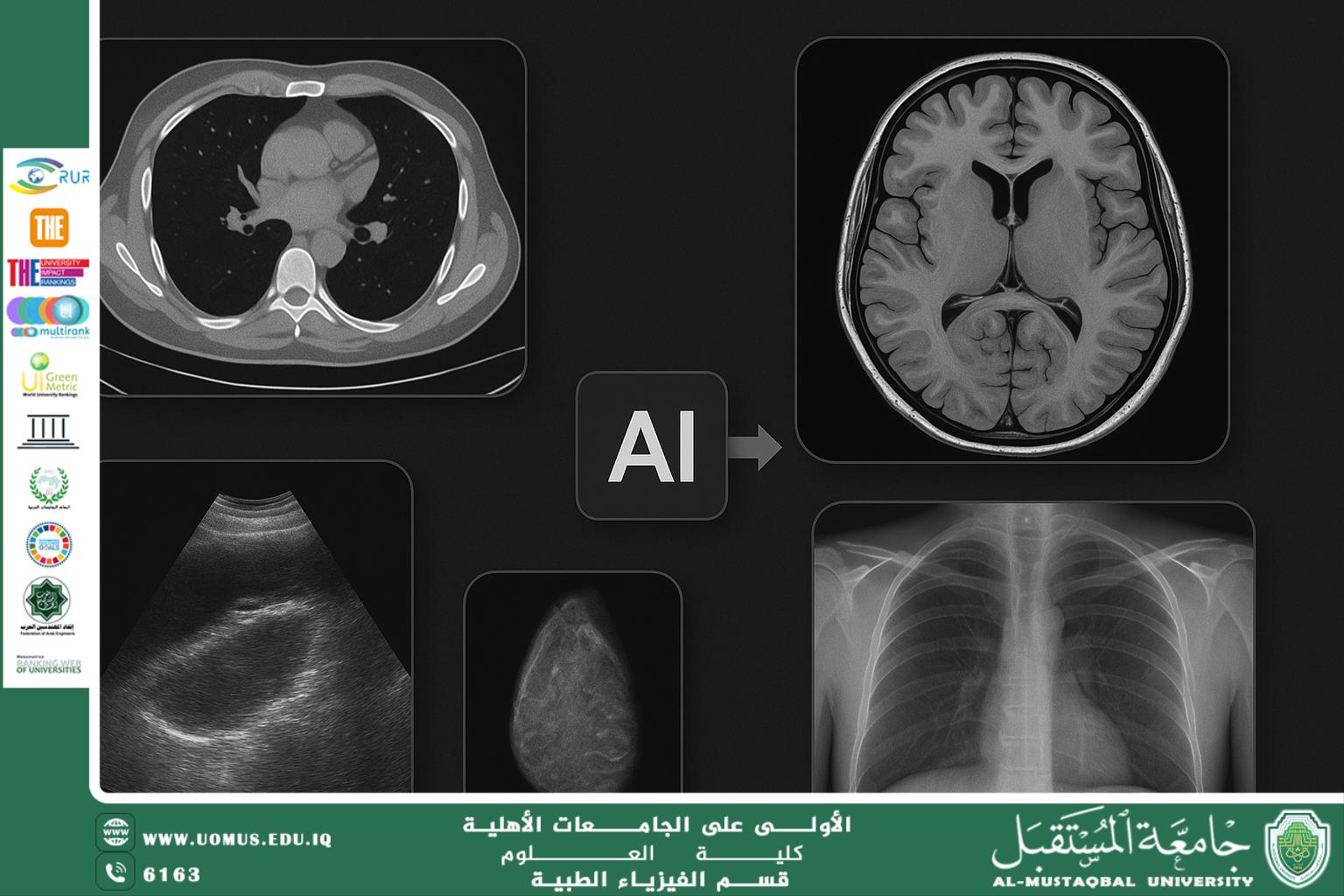 A scientific article by the administrator (Nargis Jassim) entitled “Improving the quality of medical images using reconstruction techniques”