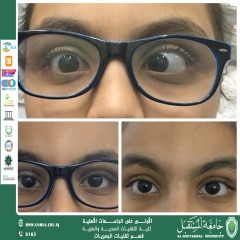 مقالة علمية لرئيس قسم تقنيات البصريات أ.م.د.منذر سمين شكر بعنوان(علاج الكسل الوظيفي للعين وتحسين الرؤيا  بالتمارين الفيزيائية)