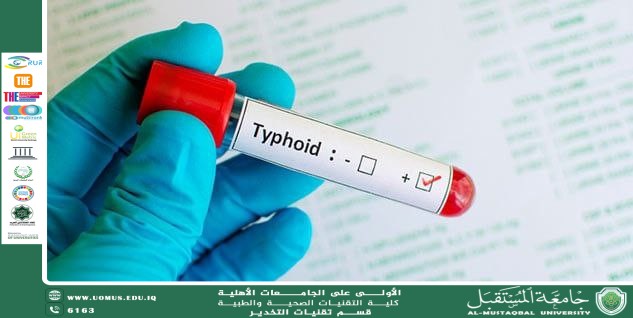 التيفوئيد: المرض الصامت الذي يهدد الصحة العامة