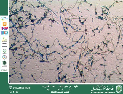 مقالة علمية للمعيدة بنين معن كريم بعنوان "التوصيف الجزيئي لسلالات بكتيرية متعددة المقاومة في المياه"