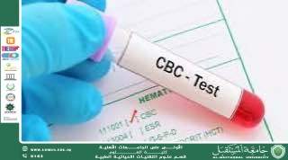 مقالة علمية للمعيدة ( مدلولة مؤيد فايق ) بعنوان ""تحليل CBC""