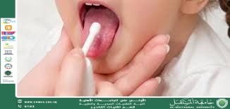 التهاب اللوزتين عند الأطفال.................