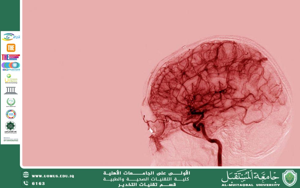 إدارة النزيف الدماغي الحاد: متى تكون الجراحة ضرورية؟