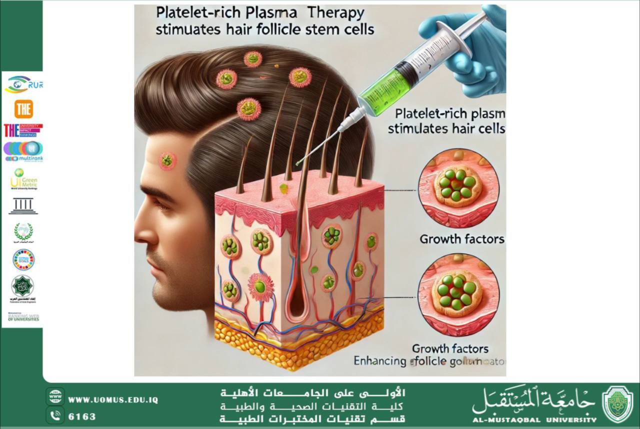 مقالة علمية للسيدة زينب مهدي بعنوان دور البلازما في تجديد الخلايا الجذعية لبصيلات الشعر 