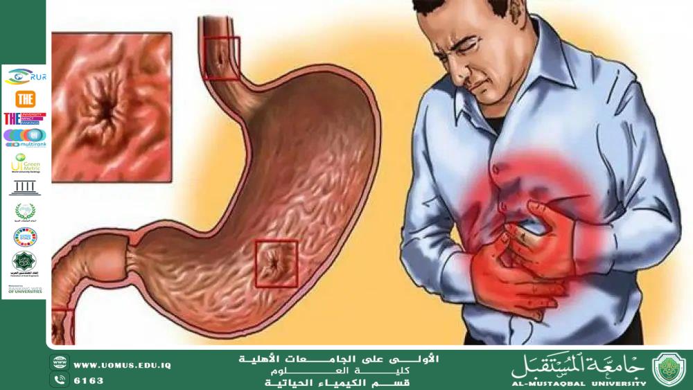مقالة علمية للمعيدة عذراء عباس بعنوان جرثومة المعدة: الكائن الدقيق الذي يهدد صحة الجهاز الهضمي