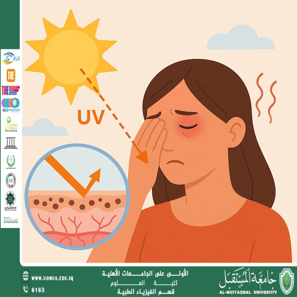 A scientific article by the lecturer (Assistant Lecturer Samaher Saad) entitled “The effect of ultraviolet rays on skin and eye health”