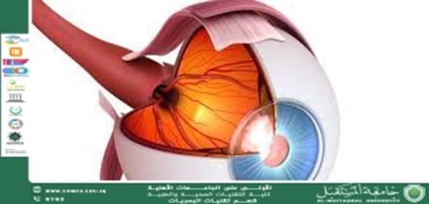 مقالة علمية للتدريسي م.م مهيمن سمير عارف بعنوان (نموذج عضلات العين التفاعلي: أداة تعليمية مبتكرة لفهم حركة العين).