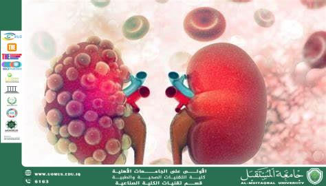 مرض الكلى المزمن (CKD): التحديات والآفاق العلاجية